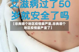【非典哪个地区疫情最严重,非典哪个地区疫情最严重了】