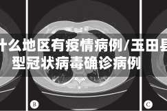 玉田什么地区有疫情病例/玉田县新型冠状病毒确诊病例