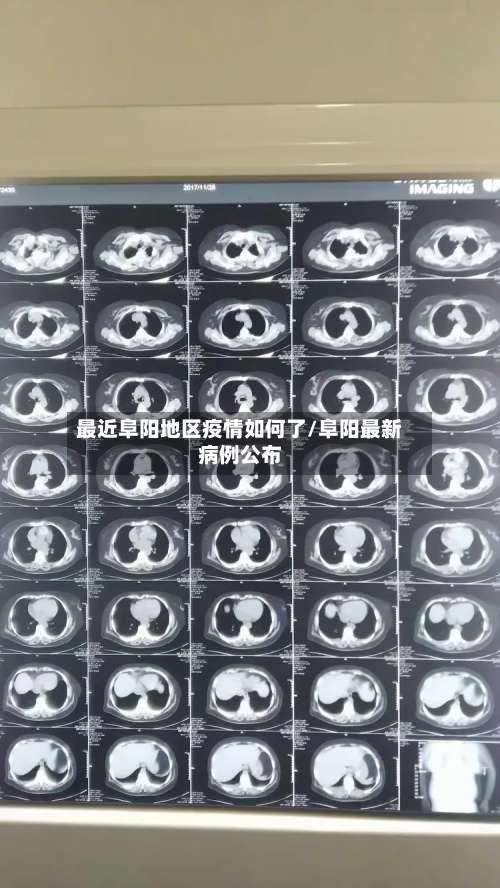 最近阜阳地区疫情如何了/阜阳最新病例公布-第2张图片