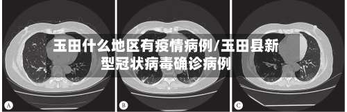 玉田什么地区有疫情病例/玉田县新型冠状病毒确诊病例-第1张图片