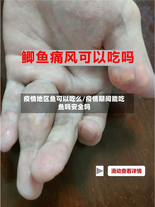 疫情地区鱼可以吃么/疫情期间能吃鱼吗安全吗-第2张图片