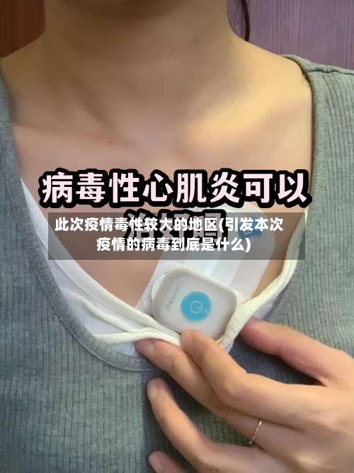 此次疫情毒性较大的地区(引发本次疫情的病毒到底是什么)-第1张图片